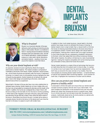 Dental Implants and Bruxism article
